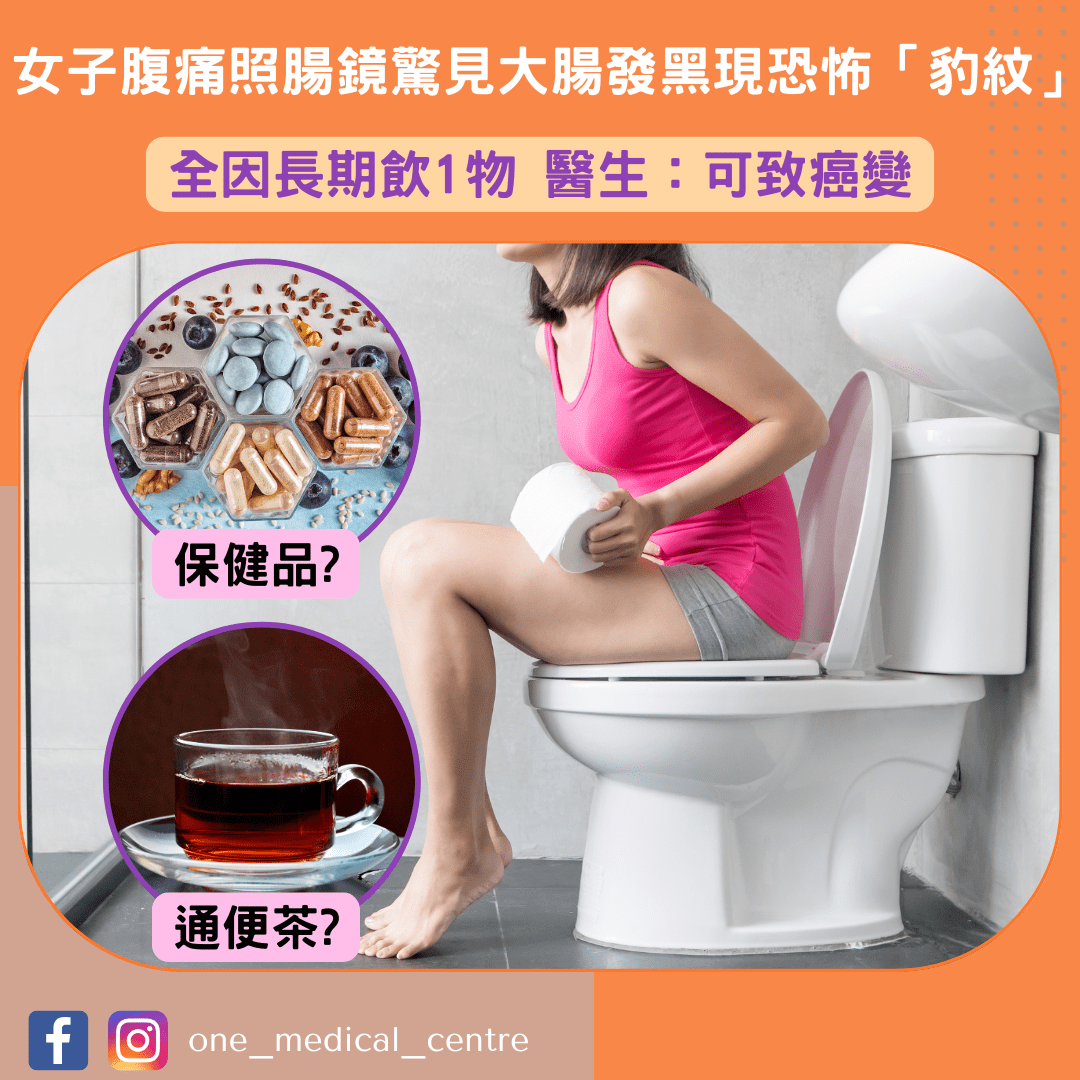 【女子腹痛照腸鏡驚見　大腸發黑現恐怖「豹紋」　全因長期飲1物 醫生：可致癌變】